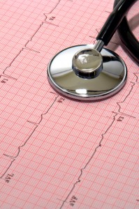 Stress Echocardiogram